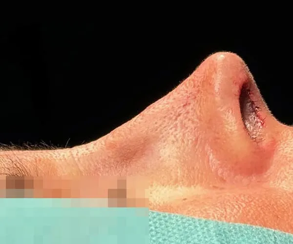 After image