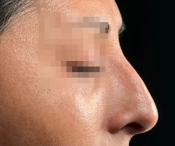 Before image