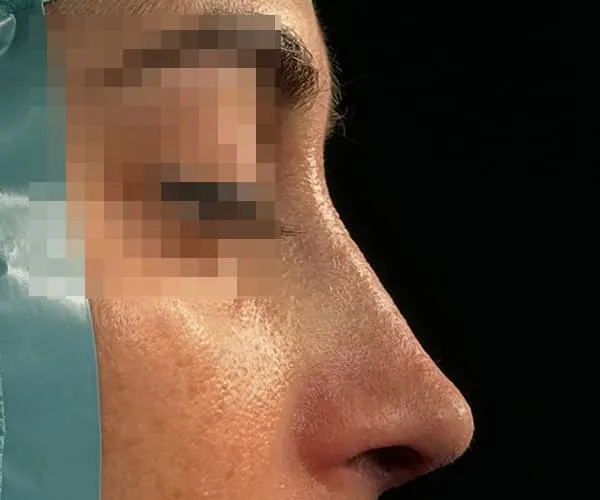 After image
