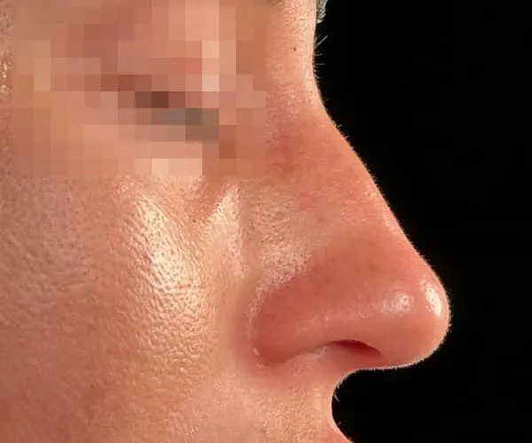 Before image
