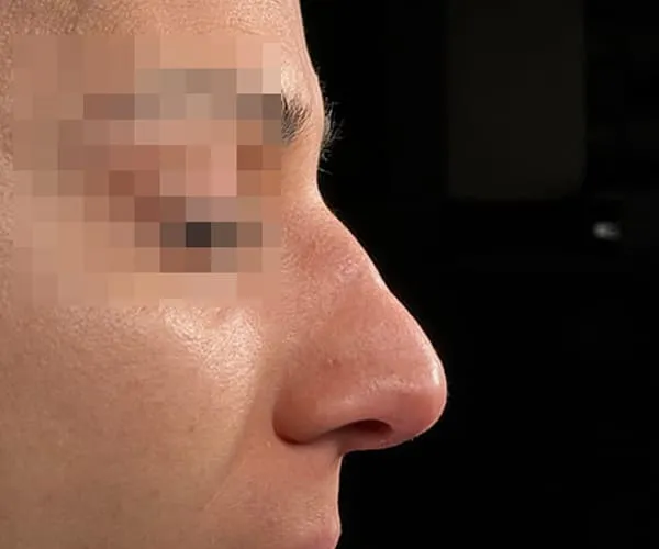 Before image